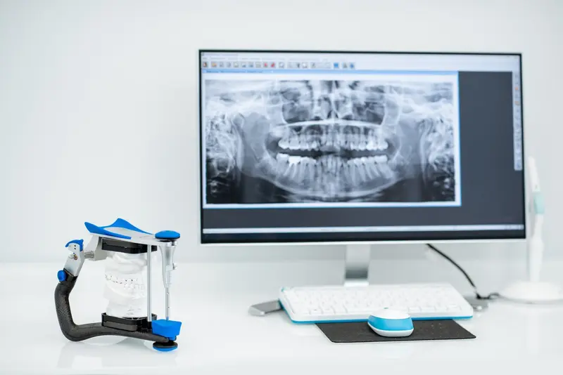 Zdjęcie pantomograficzne zębów na monitorze w gabinecie